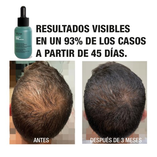 Programa anticaída: Concentrado 50 ml + Champú Peptide T98 - Imagen 10