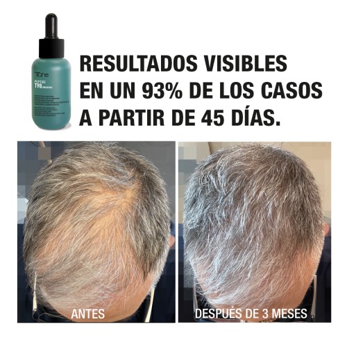 Programa anticaída: Concentrado 50 ml + Champú Peptide T98 - Imagen 11